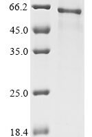 Bovine Hepatocyte growth factor (HGF), partial Recombinant Protein - BioCrest Sci