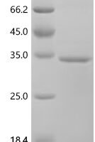 Human Transmembrane protease serine 7 (TMPRSS7), partial Recombinant Protein - BioCrest Sci
