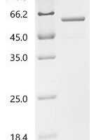 Human ATP synthase F(1) complex subunit beta, mitochondrial (ATP5F1B) Recombinant Protein - BioCrest Sci