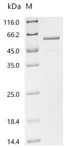 Human ATP synthase F(1) complex subunit beta, mitochondrial (ATP5F1B) Recombinant Protein, Homo sapiens (Human), E.coli, C-terminal 6xHis-tagged, 58.7 kDa, purity >≥ 85% as determined by SDS-PAGE.