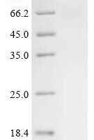 Human Methyltransferase-like protein 17, mitochondrial (METTL17) Recombinant Protein, C-10His - BioCrest Sci