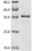 Human Gamma-aminobutyric acid receptor subunit alpha-3 (GABRA3), partial Recombinant Protein - BioCrest Sci
