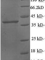 Human Protein Wnt-3a (WNT3A), partial Recombinant Protein, N-His - BioCrest Sci
