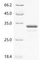 Escherichia coli Ferrichrome-iron receptor (fhuA), partial Recombinant Protein, N-His-Trx - BioCrest Sci