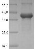 Human Amelogenin, X isoform (AMELX) Recombinant Protein, N-His-SUMO - BioCrest Sci