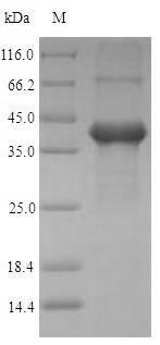 Human Amelogenin, X isoform (AMELX) Recombinant Protein, N-His-SUMO, Homo sapiens (Human), E.coli, N-terminal 6xHis-SUMO-tagged, 35.9 kDa, purity >≥ 90% as determined by SDS-PAGE.