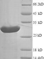 Human Agouti-related protein (AGRP) Recombinant Protein, N-His-SUMO - BioCrest Sci