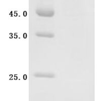 Human Cadherin-20 (CDH20), Partial Recombinant Protein - BioCrest Sci