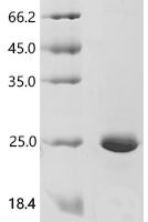 Human Transcription factor LBX1 (LBX1), partial Recombinant Protein - BioCrest Sci