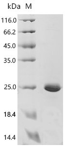 Human Transcription factor LBX1 (LBX1), partial Recombinant Protein, Homo sapiens (Human), E.coli, C-terminal 6xHis-tagged, 18.6 kDa, purity >≥ 90% as determined by SDS-PAGE.