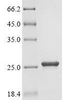 Azotobacter vinelandii  Uncharacterized protein Recombinant Protein - BioCrest Sci