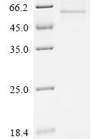 Human Mitogen-activated protein kinase 8 (MAPK8), partial Recombinant Protein - BioCrest Sci