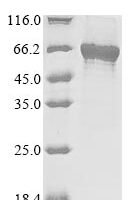 Human Polypeptide N-acetylgalactosaminyltransferase-like 6 (GALNTL6), partial Recombinant Protein - BioCrest Sci