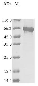 Human Polypeptide N-acetylgalactosaminyltransferase-like 6 (GALNTL6), partial Recombinant Protein, Homo sapiens (Human), E.coli, N-terminal 6xHis-tagged, 70.7 kDa, purity >≥ 85% as determined by SDS-PAGE.