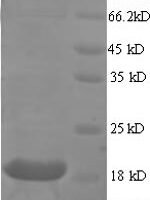 Human Myosin regulatory light chain 2, ventricular/cardiac muscle isoform (MYL2), partial Recombinant Protein - BioCrest Sci