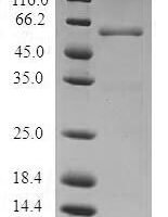 Human Proteasome activator complex subunit 1 (PSME1) Recombinant Protein - BioCrest Sci