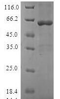 Human Sulfotransferase 1A3 (SULT1A3) Recombinant Protein - BioCrest Sci