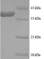 Human L-lactate dehydrogenase B chain (LDHB) Recombinant Protein, N-His - BioCrest Sci
