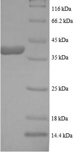 Human L-lactate dehydrogenase B chain (LDHB) Recombinant Protein, N-His, Homo sapiens (Human), E.coli, N-terminal 6xHis-tagged, 40.5 kDa, purity >≥ 90% as determined by SDS-PAGE.
