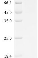 Mouse Semaphorin-3C (Sema3c) Recombinant Protein - BioCrest Sci