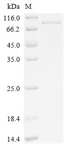 Mouse Semaphorin-3C (Sema3c) Recombinant Protein, Mus musculus (Mouse), Baculovirus, C-terminal 10xHis-tagged, 84.5 kDa, purity >≥ 85% as determined by SDS-PAGE.