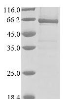 Human E3 ubiquitin-protein ligase RNF8 (RNF8) (C403S, C406S) Recombinant Protein - BioCrest Sci