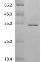 Human E3 ubiquitin-protein ligase CHIP (STUB1) Recombinant Protein, Tag-Free - BioCrest Sci