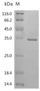 Human E3 ubiquitin-protein ligase CHIP (STUB1) Recombinant Protein, Tag-Free, Homo sapiens (Human), E.coli, Tag-Free, 35.0 kDa, purity >≥ 95% as determined by SDS-PAGE.