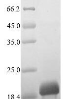 Tyrophagus putrescentiae Mite group 2 allergen Tyr p 2 Recombinant Protein - BioCrest Sci