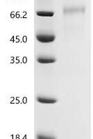 Human Growth/differentiation factor 9 (GDF9) Recombinant Protein, C-10His - BioCrest Sci