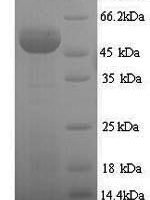 Human Sulfite oxidase, mitochondrial (SUOX) Recombinant Protein - BioCrest Sci
