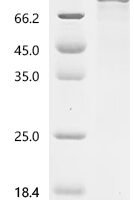 Human Toll-like receptor 9 (TLR9), partial Recombinant Protein - BioCrest Sci
