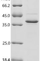 Bovine Enteropeptidase (TMPRSS15), partial Recombinant Protein - BioCrest Sci