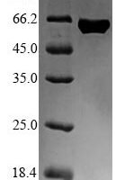 Escherichia coli Flagellin (fliC) Recombinant Protein, N-His-SUMO - BioCrest Sci