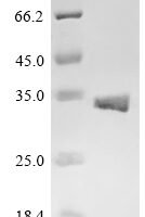 Escherichia phage lambda Antiholin (S), partial Recombinant Protein - BioCrest Sci
