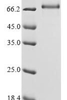 Human Protein Mdm4 (MDM4) Recombinant Protein - BioCrest Sci