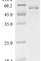 Mouse Atrial natriuretic peptide receptor 2 (Npr2), partial Recombinant Protein - BioCrest Sci