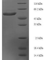 Human Interleukin-22 receptor subunit alpha-1 (IL22RA1), partial Recombinant Protein - BioCrest Sci