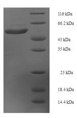 Human Interleukin-22 receptor subunit alpha-1 (IL22RA1), partial Recombinant Protein, Homo sapiens (Human), E.coli, N-terminal 6xHis-SUMO-tagged, 50.8 kDa, purity >≥ 90% as determined by SDS-PAGE.