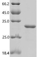 Mouse Cardiotrophin-1 (Ctf1) Recombinant Protein, C-His - BioCrest Sci