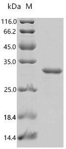 Mouse Cardiotrophin-1 (Ctf1) Recombinant Protein, C-His, Mus musculus (Mouse), E.coli, C-terminal 6xHis-tagged, 28.4 kDa, purity >≥ 95% as determined by SDS-PAGE.