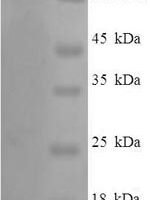 Human Vitamin K-dependent protein S (PROS1) Recombinant Protein - BioCrest Sci