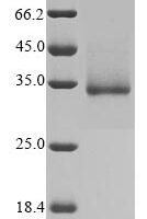 Severe acute respiratory syndrome coronavirus 2 Spike glycoprotein (S) (N354D,D364Y), partial Recombinant Protein - BioCrest Sci