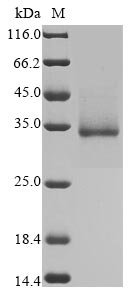 Severe acute respiratory syndrome coronavirus 2 Spike glycoprotein (S) (N354D,D364Y), partial Recombinant Protein, Severe acute respiratory syndrome coronavirus 2 (2019-nCoV) (SARS-CoV-2), Mammalian cell, C-terminal 10xHis-tagged, 30.1 kDa, purity >≥ 90% as determined by SDS-PAGE.