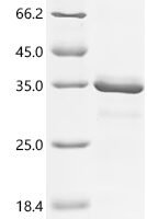 Streptococcus sp. group G Immunoglobulin G-binding protein G (spg), partial Recombinant Protein, N-10His - BioCrest Sci