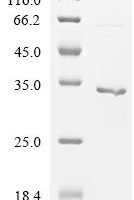 Human Alpha-protein kinase 1 (ALPK1), partial Recombinant Protein - BioCrest Sci