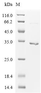 Human Alpha-protein kinase 1 (ALPK1), partial Recombinant Protein, Homo sapiens (Human), E.coli, C-terminal 6xHis-tagged, 33.0 kDa, purity >≥ 90% as determined by SDS-PAGE.