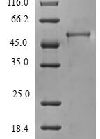 Human Charged multivesicular body protein 4b (CHMP4B) Recombinant Protein, N-GST - BioCrest Sci