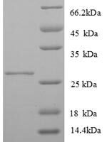 Human MHC class II antigen (HLA-DQB1), partial Recombinant Protein - BioCrest Sci