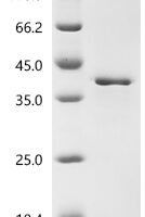 Staphylococcus aureus Large ribosomal subunit protein uL2 (rplB) Recombinant Protein - BioCrest Sci